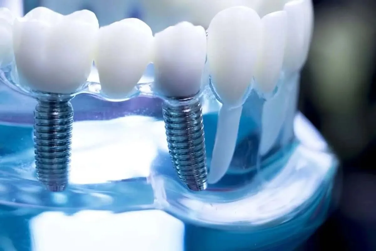 Smith Family Dentistry WV — photo 2