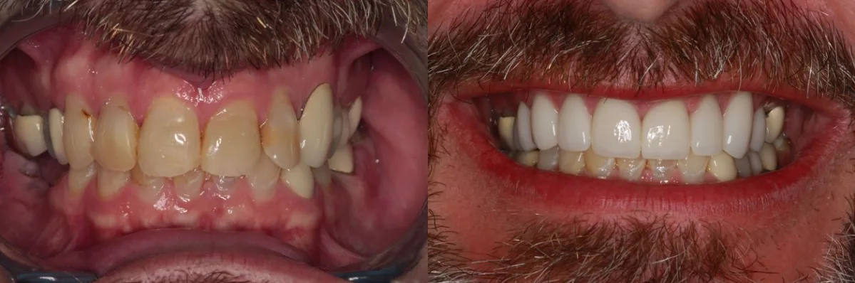 Southern Dental Implant Center — photo 2