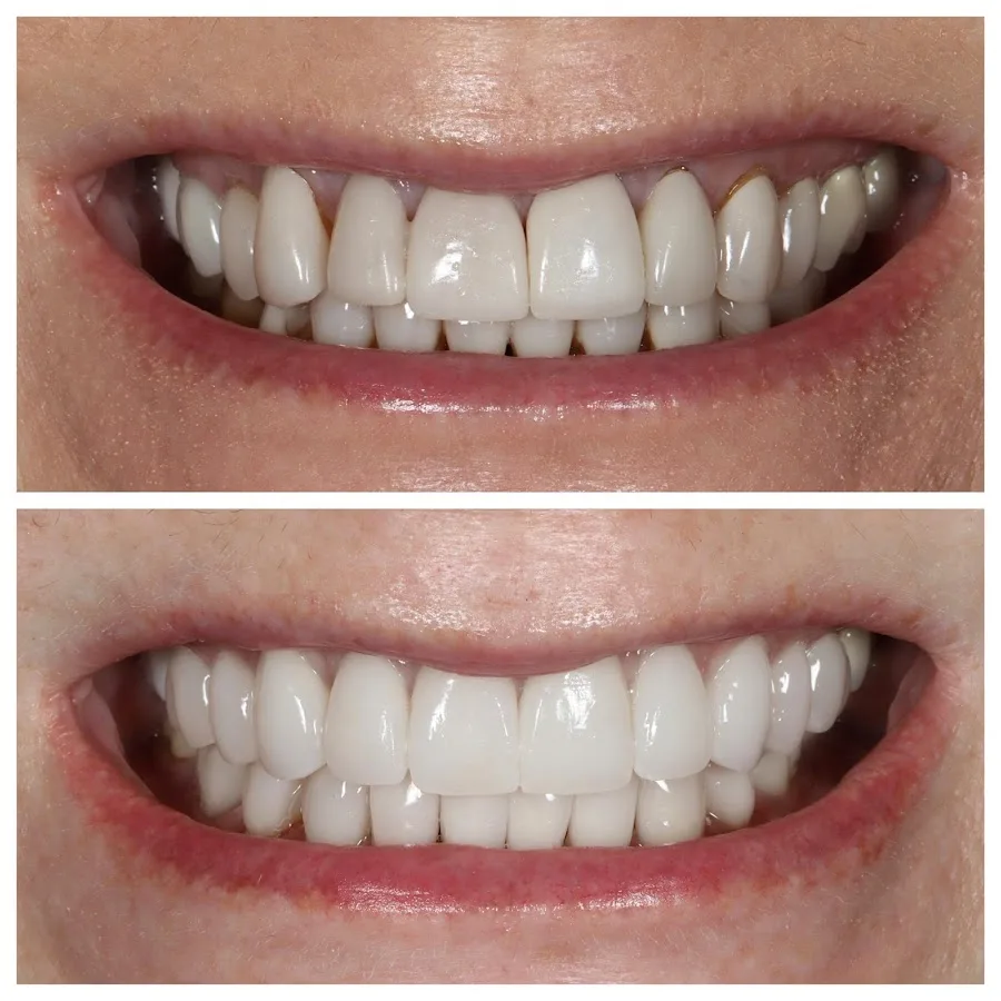 The New York Center for Cosmetic Dentistry — photo 3