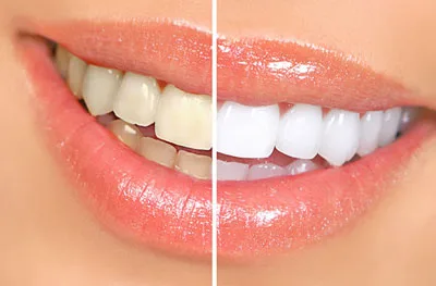 White Smile Center — photo 3