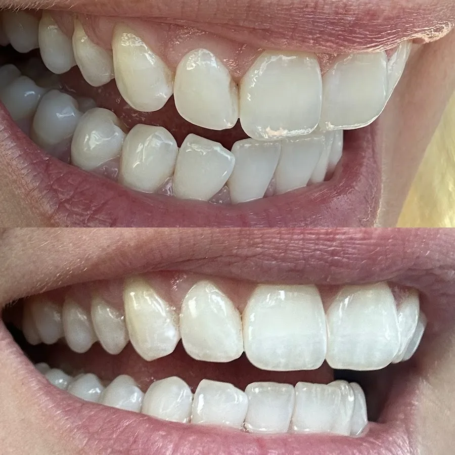 Wilshire Smile Studio - Los Angeles Dentist, Cosmetic and Emergency Dentistry — photo 5